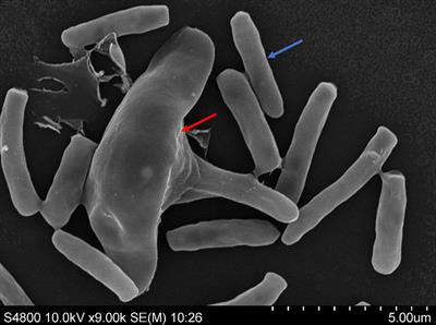 Third Generation Genome Sequencing Reveals That Endobacteria in Nematophagous Fungi Esteya vermicola Contain Multiple Genes Encoding for <mark class="highlighted">Nematicidal</mark> Proteins